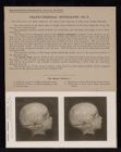 Cranio-Cerebral Topography - no. 3
